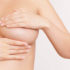 Questions sur la chirurgie des seins