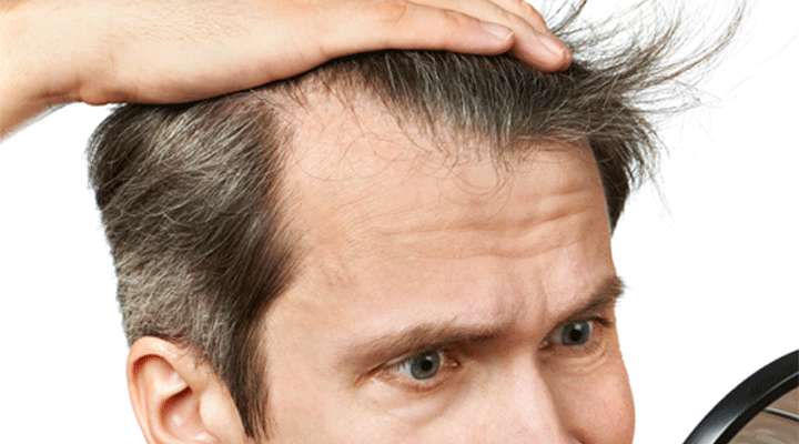 Poudre densifiante: un produit pour les cheveux clairsemés.