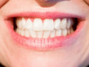Avoir de belles dents