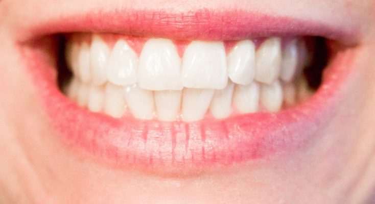 Avoir de belles dents