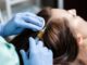 Mesotherapie capillaire